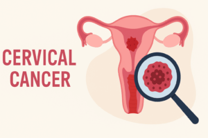 "한 방의 주사로 암을 막는다고요? HPV 백신의 놀라운 힘" 4